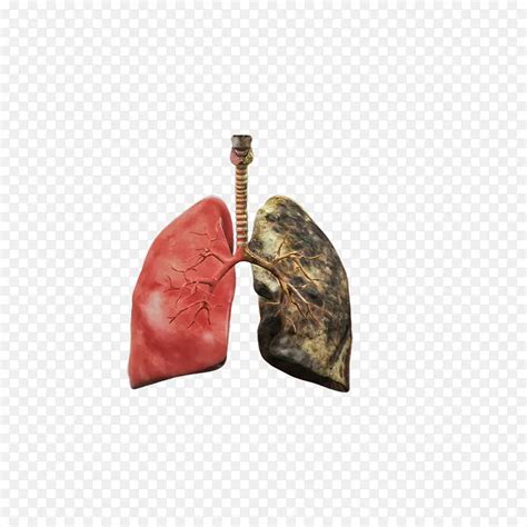 吸烟者的肺图片