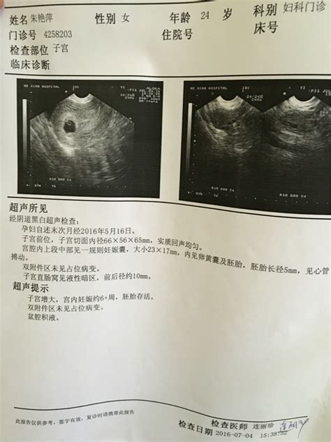 奥特曼b超单图片