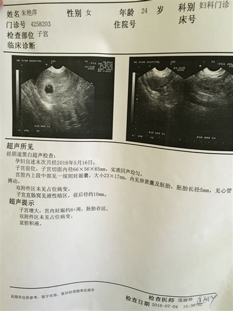 孕早期B超能告诉我们什么？ - 知乎