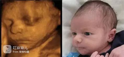 胎儿的四维照片，跟实际相貌有区别吗？看看照片前后对比一目了然 - 百度宝宝知道