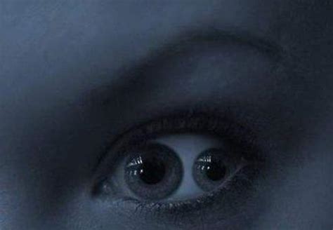 双瞳孔的人眼中的世界到底是什么样子？看完解开多年疑惑！