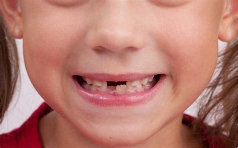 孩子门牙掉了什么时候能长出来 孩子门牙掉了急救处理方法 _八宝网