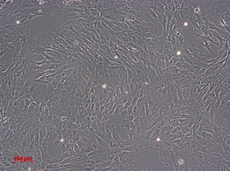AsPC-1细胞ATCC CRL-1682细胞 AsPC1人转移胰腺腺癌细胞株购买价格、培养基、培养条件、细胞图片、特征等基本信息_生物风