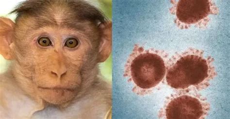 【关注】广东7月新增报告115例猴痘病例，有这4个特点