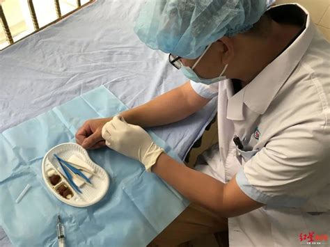 红星新闻|是个“狠人”！四川骨科医生自己给自己做手术，成功了！ 四川遂宁市第一人