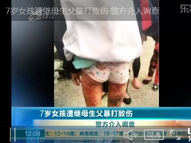 视频曝光：7岁女孩遭继母生父暴打致伤