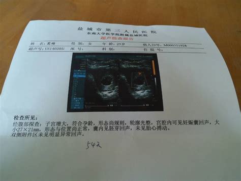 怀孕产检全过程（280天孕检时间表）_360新知
