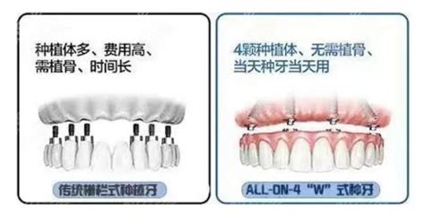 成都中诺口腔种植牙价格表，种一颗牙/半口/全口收费有补贴 - 口腔资讯 - 牙齿矫正网