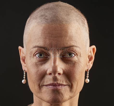 因癌症而接受化疗的秃顶女人正在掉头发照片摄影图片_ID:312462885-Veer图库