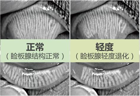 神经 的图像结果