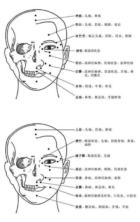 头痛区域说明图,头疼位置与,头痛位置分布图_大山谷图库