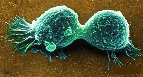 日本看病：NK免疫细胞是什么，有什么作用_多睦健康海外高端医疗