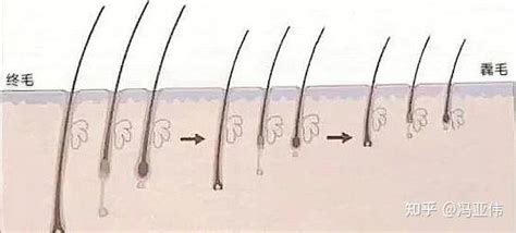 你知道一个毛囊单位有多少根毛发吗？|毛囊|毛发|密度_新浪新闻