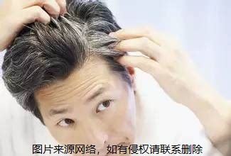 头发毛囊检测能检测出什么?做毛囊检测能查出脱发原因吗,脱发治疗-8682赴韩整形网
