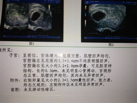 检查怀孕妇女血压的年高清图片下载-正版图片505662406-摄图网