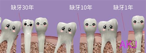 大牙缺失有什么影响？危害大吗-爱康健齿科