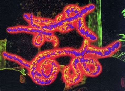 埃博拉病毒堪称真实版的丧尸病毒，比艾滋病还强一个等级_克劳斯