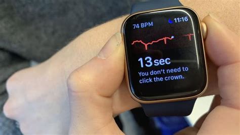 ECG功能浅析：苹果Apple Watch的心电图功能如何使用 - IT之家