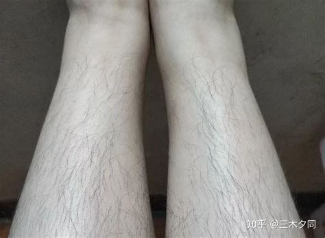 毛的图片