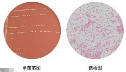 副流感嗜血杆菌 BNCCBNCC356325 微生物菌种|北纳生物