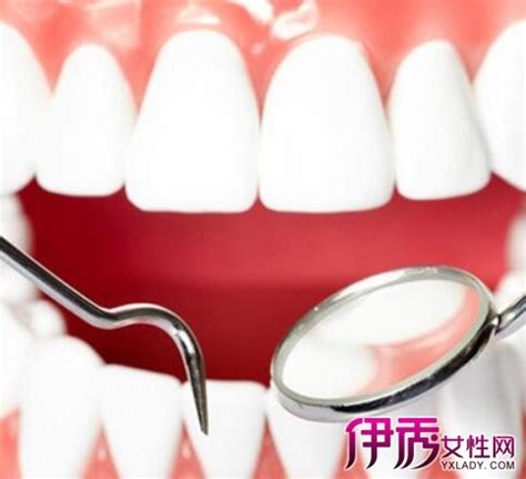 刷牙经常出血，如何更科学的预防牙龈炎？ - 知乎
