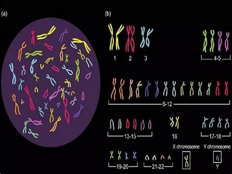 染色体异常-医联