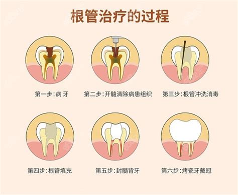 北京大学口腔医院牙科价目表分享（2022-2023） - 看牙记网