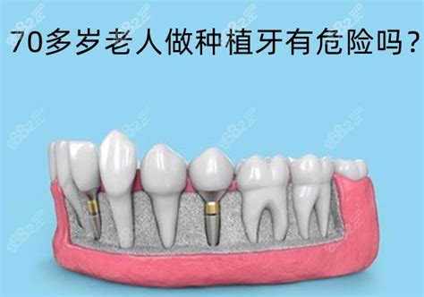 70多岁老人做种植牙有危险吗,种牙时需不需要家属陪同呢,种植牙-8682赴韩整形网