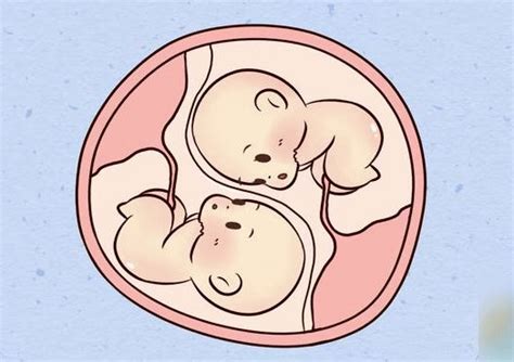 如何生同卵双胞胎？用什么方法可以怀上同卵双胞胎？ - 好孕无忧