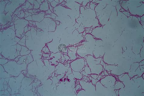 显微镜下炭疽杆菌BacillusAnthrac高清图片下载-正版图片503712887-摄图网