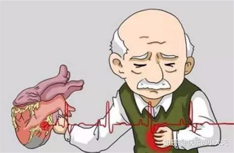 心绞痛发作下一步就是心梗？医生：5点急救，后续2方面治疗更关键 - 知乎