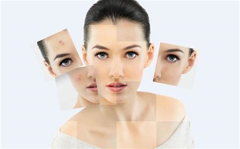 为什么越护肤越烂脸？“精简护肤”才是护肤的关键 - 知乎