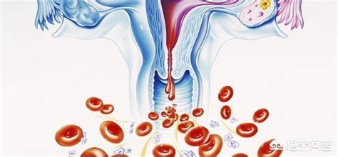 月经来时大血块就像小便一样，用什么方法可以快速止血？