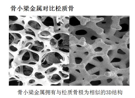 骨小梁示意图图片