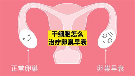 卵巢功能早衰的治疗方法_中华康网