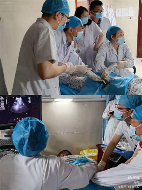 金寨县中医医院顺利开展超声引导下肾穿刺活检术,金寨县中医医院