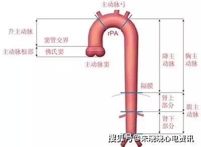 王硕教授：B超和ICGA引导下脑血管畸形的外科治疗 - 脑医汇 - 神外资讯 - 神介资讯