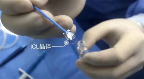 ICL晶体植入过程解析