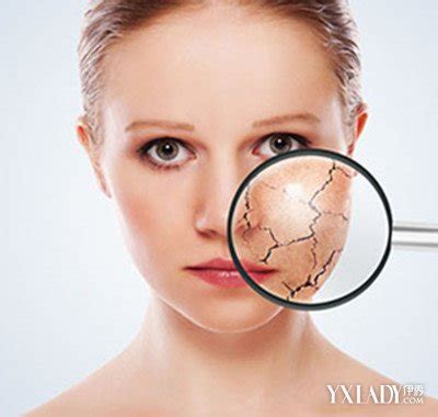 【图】皮肤过敏图片 3种常见的过敏形式(2)_过敏图片_伊秀美容网|yxlady.com