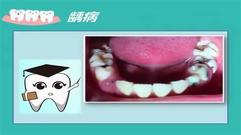 口腔科开展种植牙业务学习 - 太湖县人民医院
