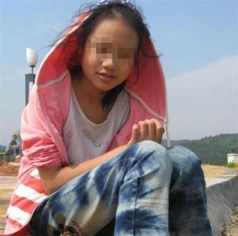 国内：江西13岁女孩患怪病 手指枯死腿脚需植皮_湖北频道_凤凰网