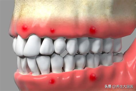 智慧牙发炎肿痛怎么办（"阳"了，牙龈肿痛、智齿发炎？莫慌！牙科医生教你正确处理） | 说明书网