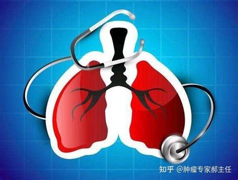 哪些肺癌患者适合放疗？中国首个肺癌放疗手册发布！ - 知乎