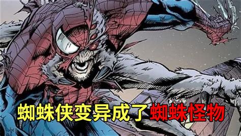 《蜘蛛侠》男孩被蜘蛛咬伤获得超能力_腾讯视频