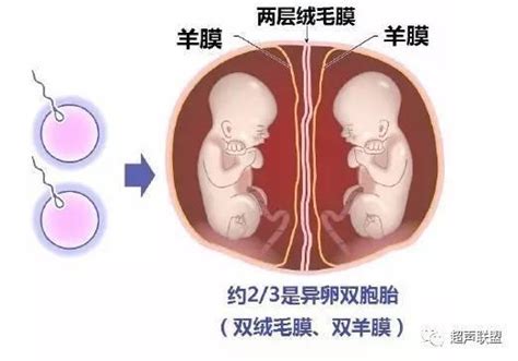 胚胎形成“时间轴”：怀孕几周可以看到孕囊、胎心胎芽？孕妈收藏
