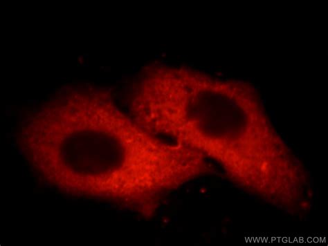 科学网—Molecular Cell：陈春龙等开发新单分子组学方法研究人类细胞DNA复制程序 - 小柯生命的博文
