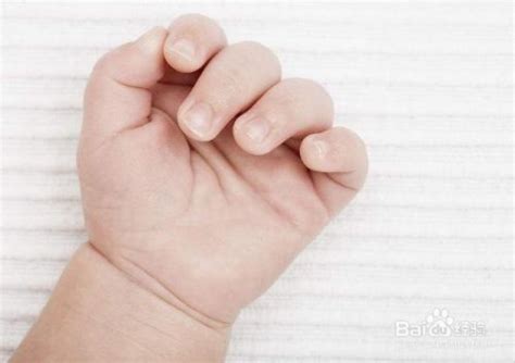 宝宝手指上起小水泡怎么办-百度经验