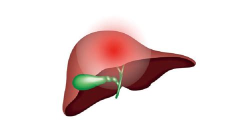乙肝男性平均寿命是多久 影响乙肝患者寿命的4因素须知-乙肝寿命-复禾健康