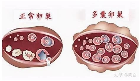 卵黄囊到胚芽需要多长时间呢？两者之间的关系，希望你不要错过|卵黄囊|胚芽|怀孕_新浪新闻