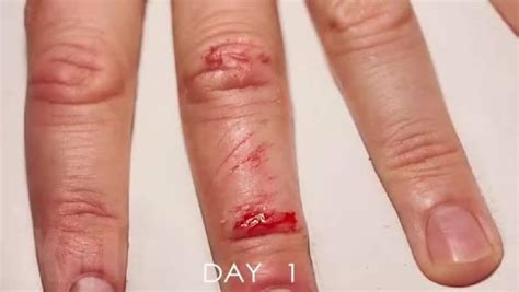 手指上的伤口在33天里的愈合过程_新浪新闻